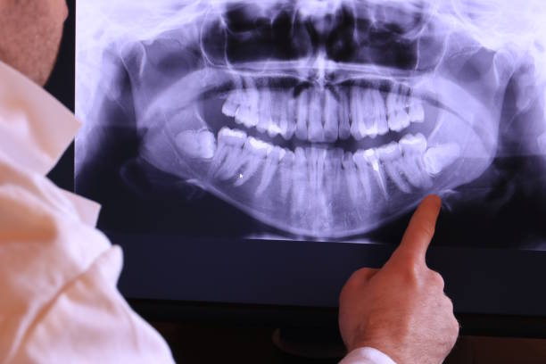 Best Chipped Tooth Repair Near Me  in Maud, TX